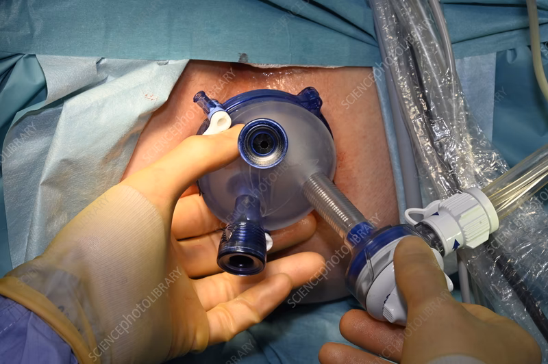 What are the benefits of Tamis surgery?