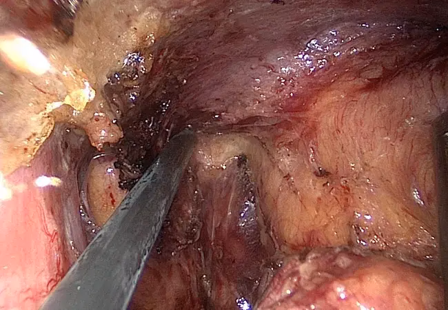 What does tatme stand for?