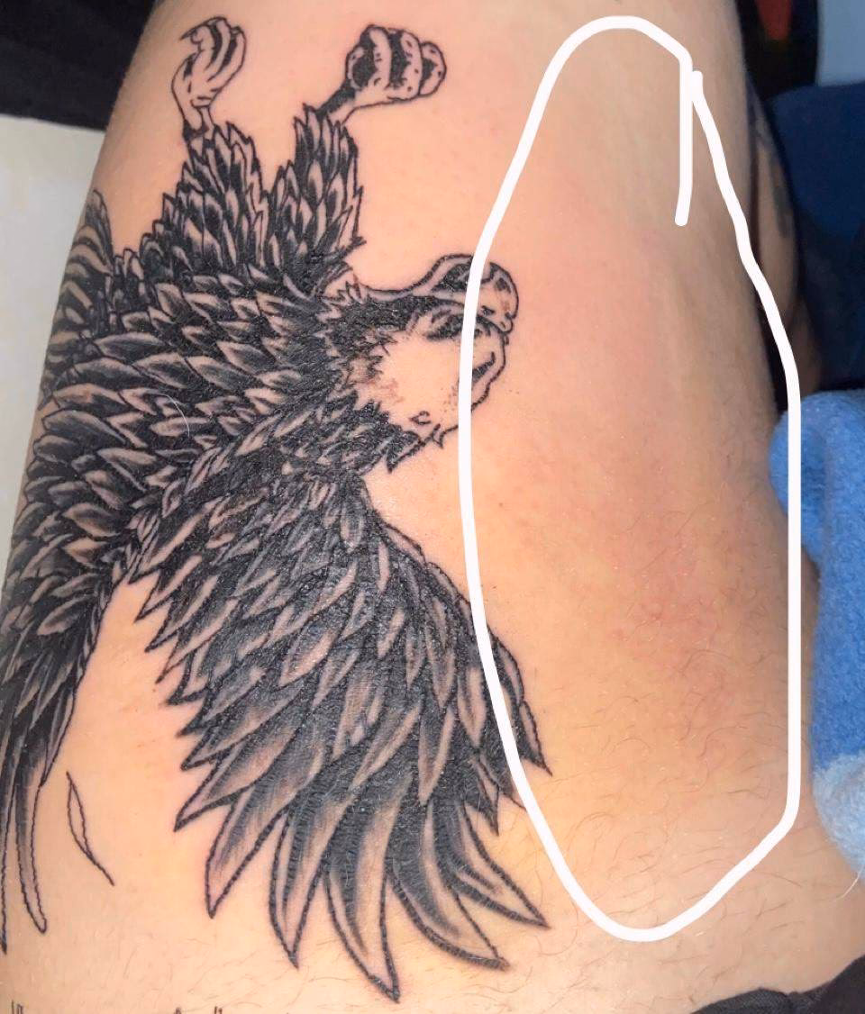 Was ist ein Allergietest vor dem Tätowieren?