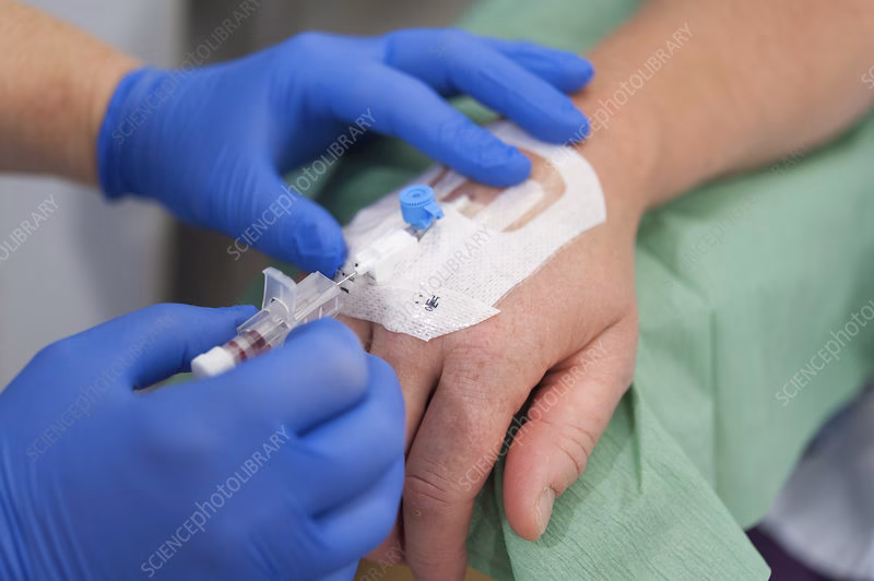 Should a cannula go into your arm or hand?