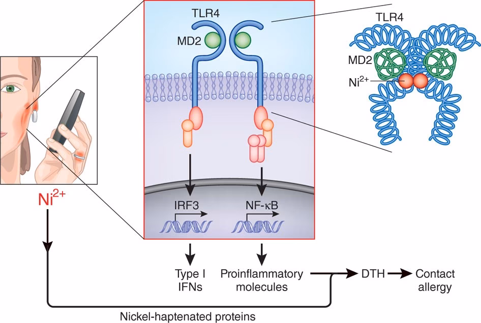 Is nickel a hazard for allergic contact dermatitis?