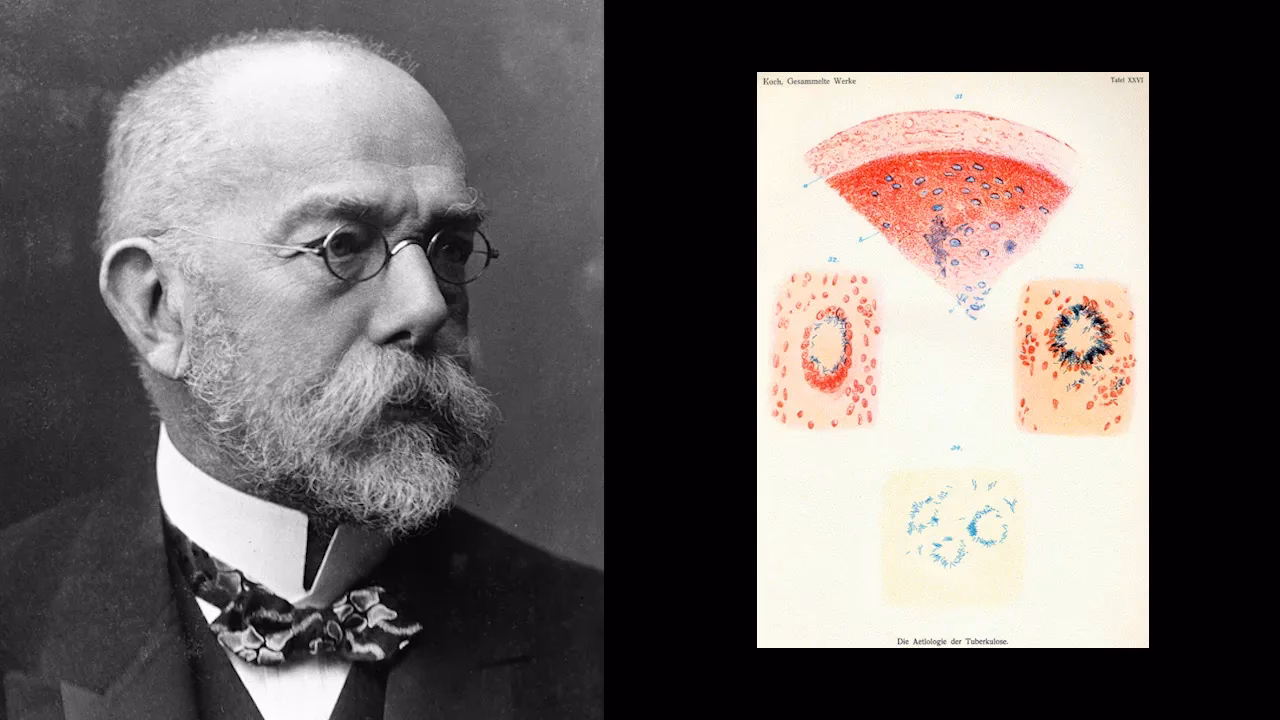 Who is considered the father of the scientific study of tuberculosis?