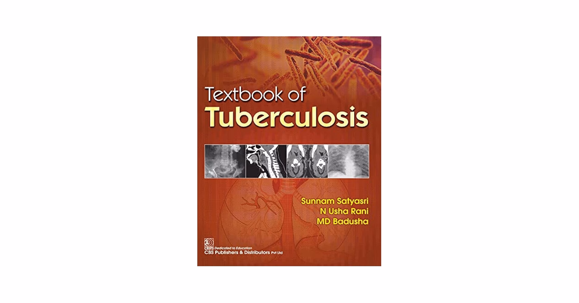 What is the who operational handbook on tuberculosis?