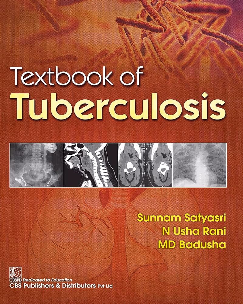 When is everything is tuberculosis out?