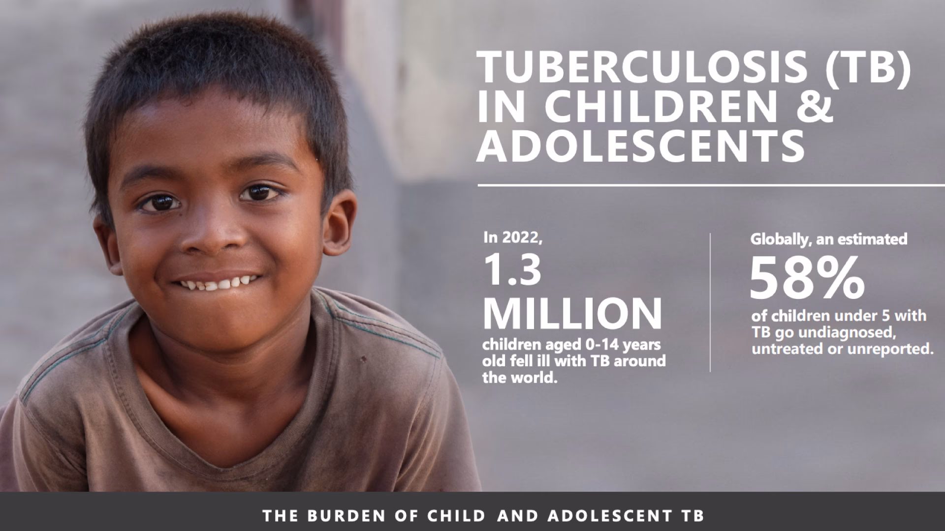 What happens if a child has TB?