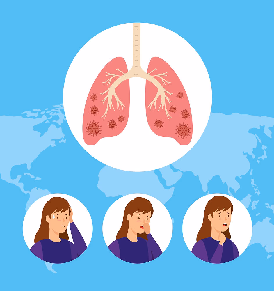 ¿Qué es la infección por tuberculosis?