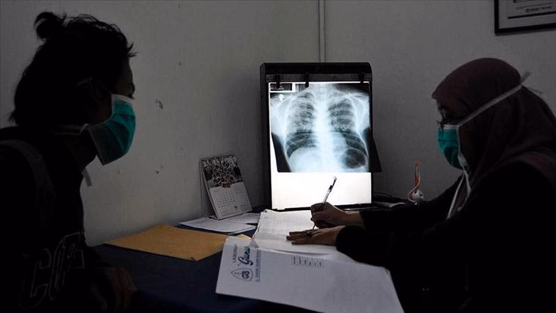 ¿Cuál es la tasa de incidencia de tuberculosis en Chile?