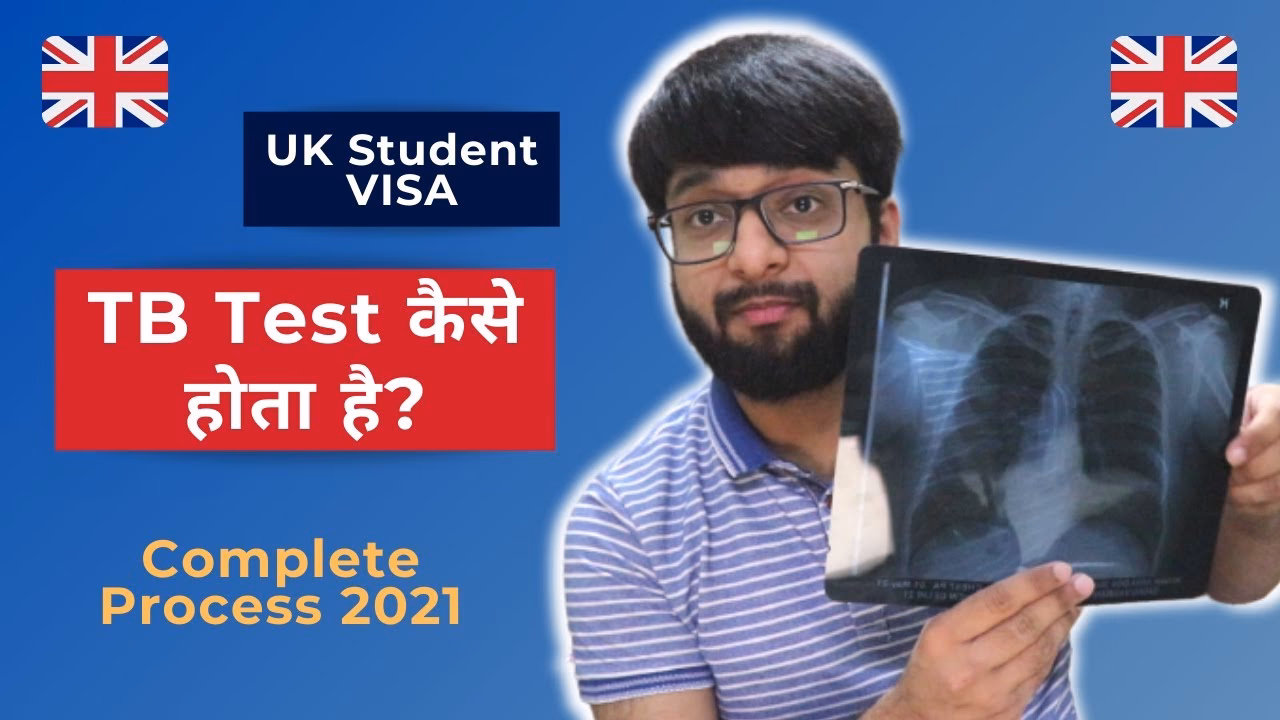 How do I get a UK visa if I have TB?