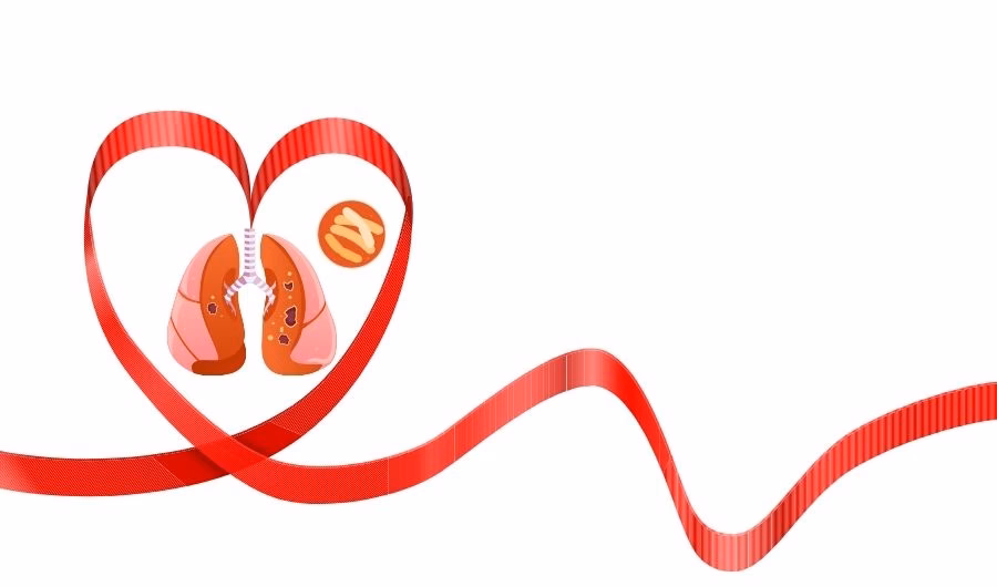 ¿Cuál es el riesgo de muerte por TB en un paciente con VIH?