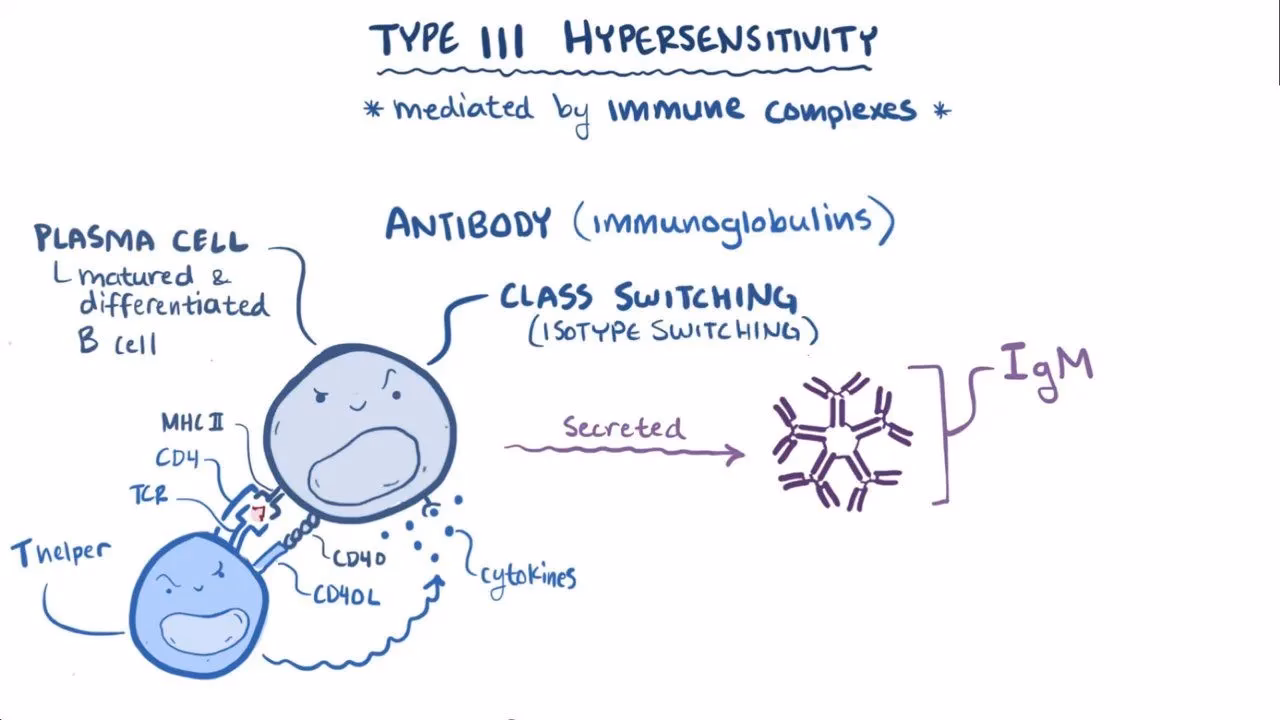 What is type III hypersensitivity?