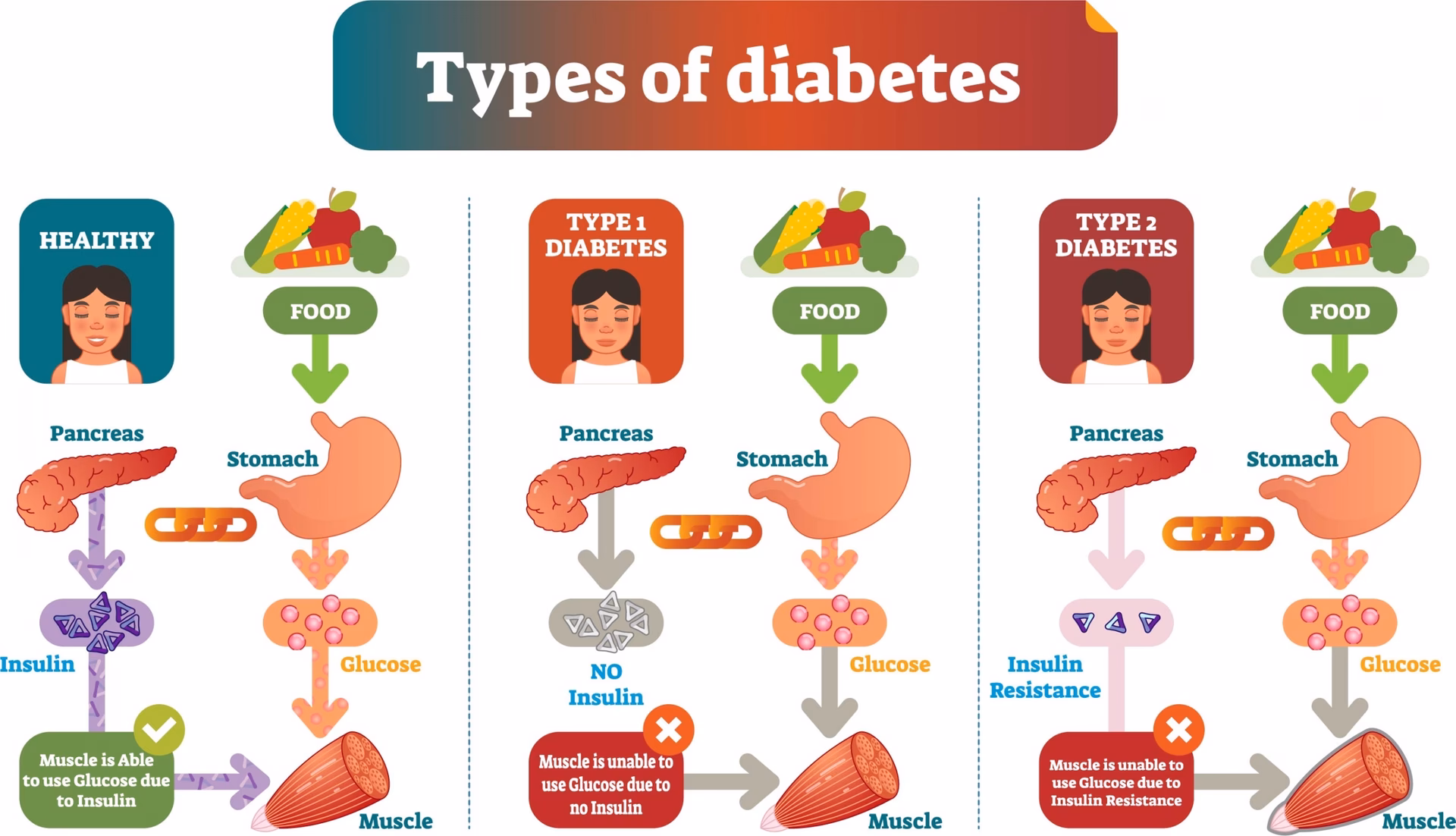 What is the difference between Type 1 and Type 2 diabetes?