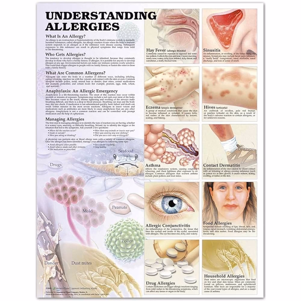 How do you differentiate allergies from other conditions?