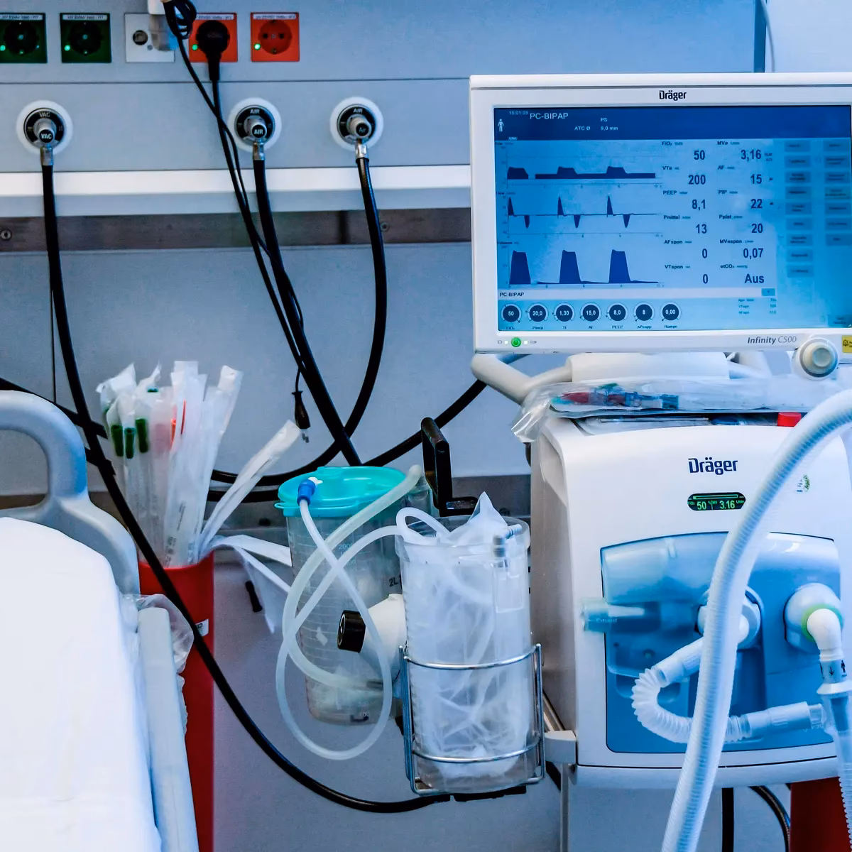 What is ventilator management in hospitals?