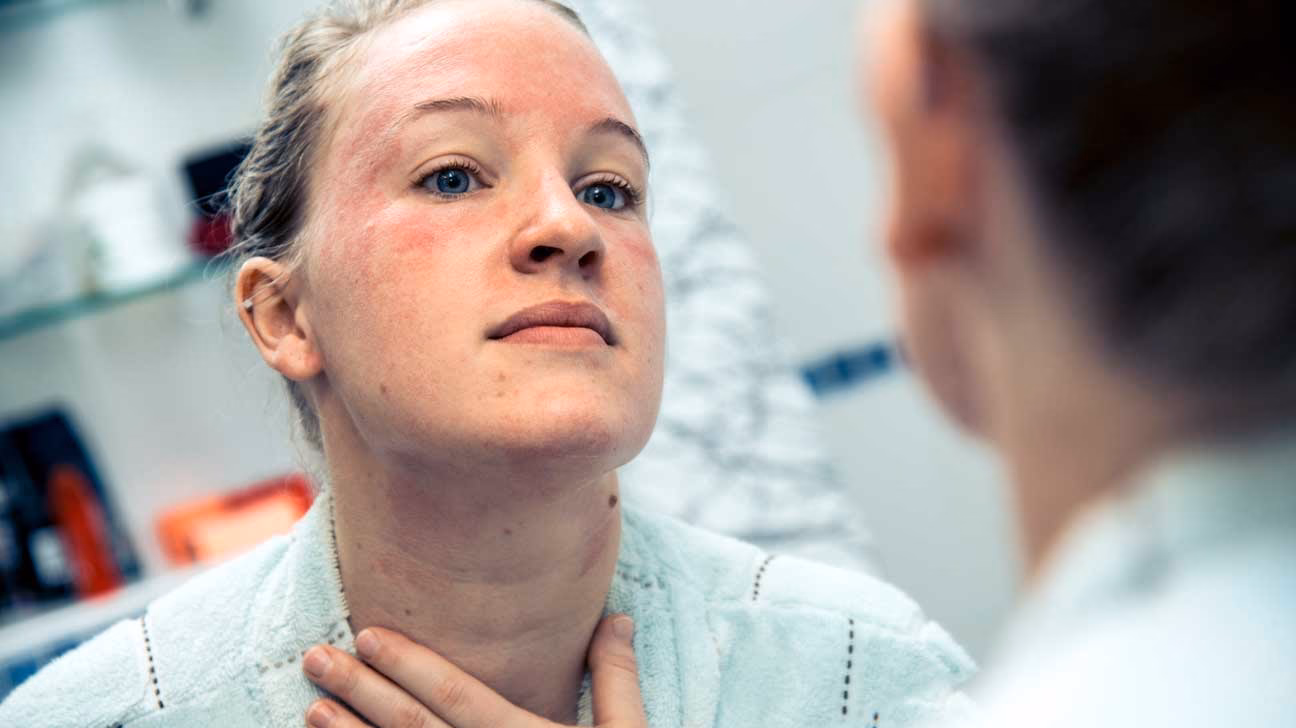 What are the symptoms of an allergic reaction to vitamin B complex?