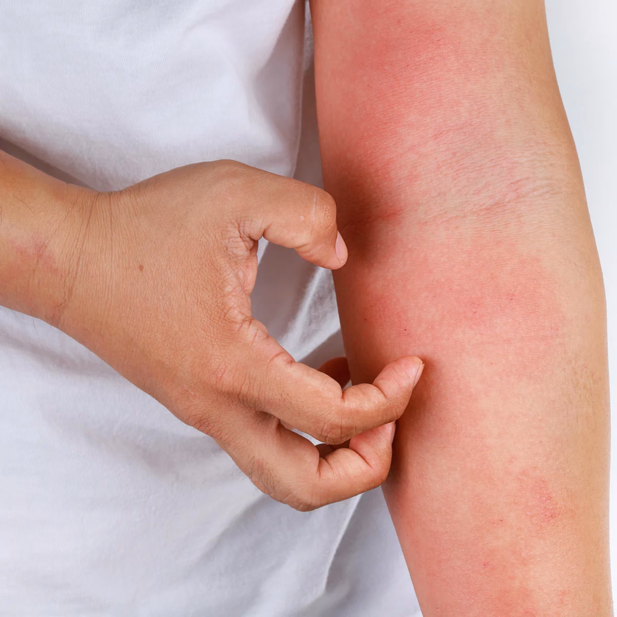 Can vitamin C help allergies?