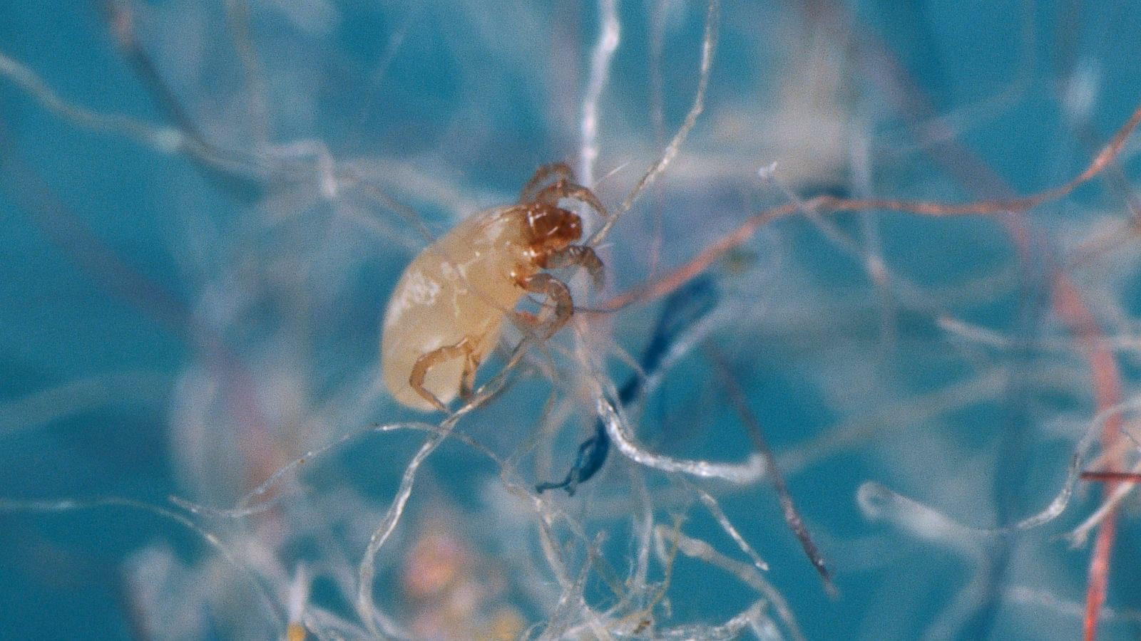 Can a combination of six allergens help diagnose a house dust mite allergy?