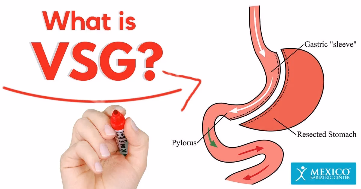 How does VSG work?