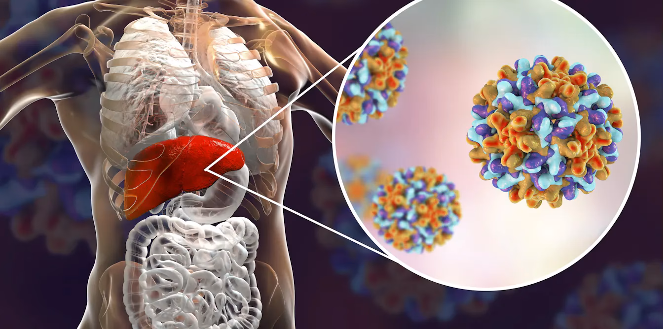 ¿Cómo tratar la hepatitis B crónica?