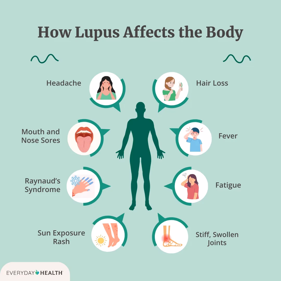 How does lupus affect the nervous system?