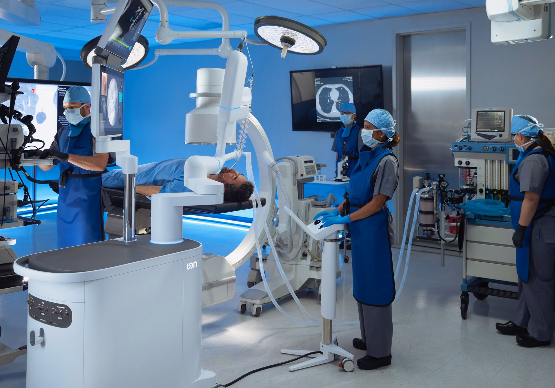 What is ion bronchoscopy & planpoint software?