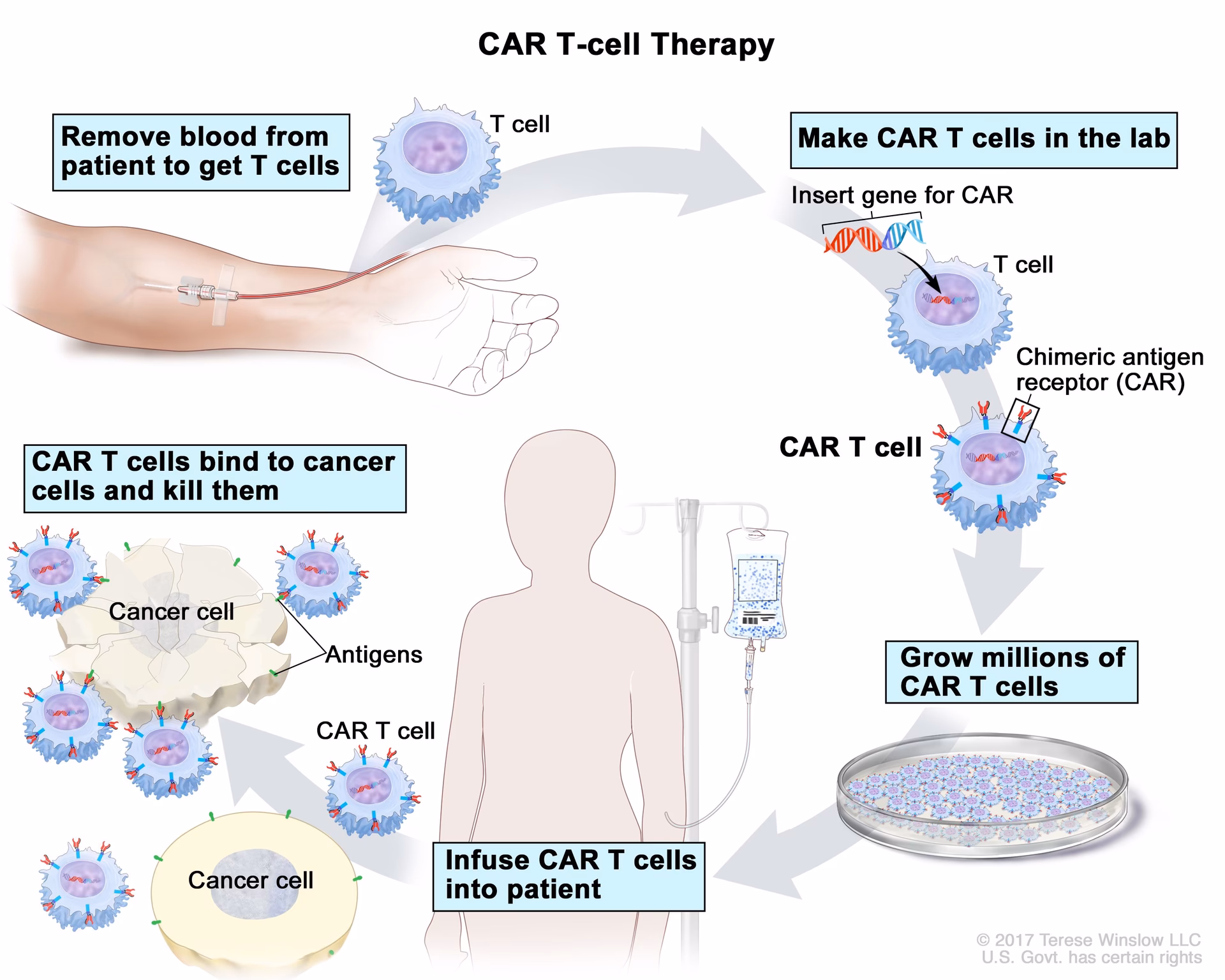 How many people are diagnosed with T-cell all?