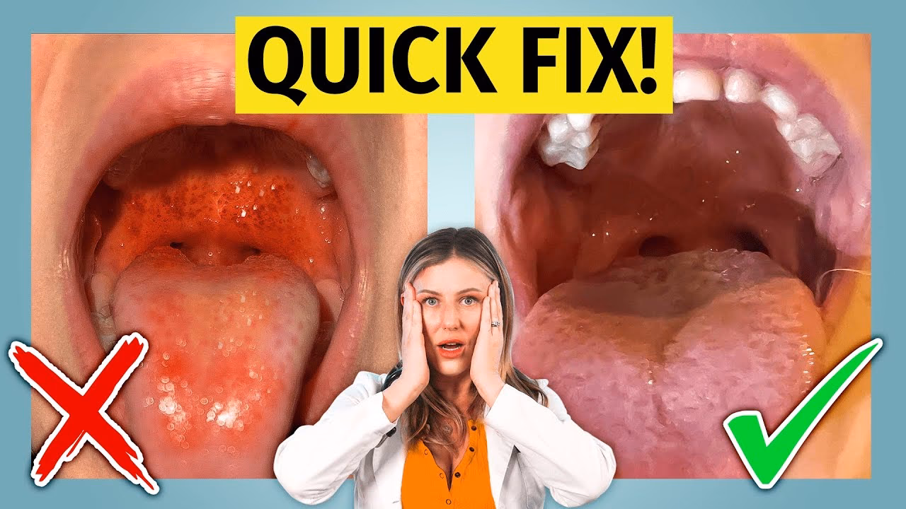 Can salt water help A strep throat?