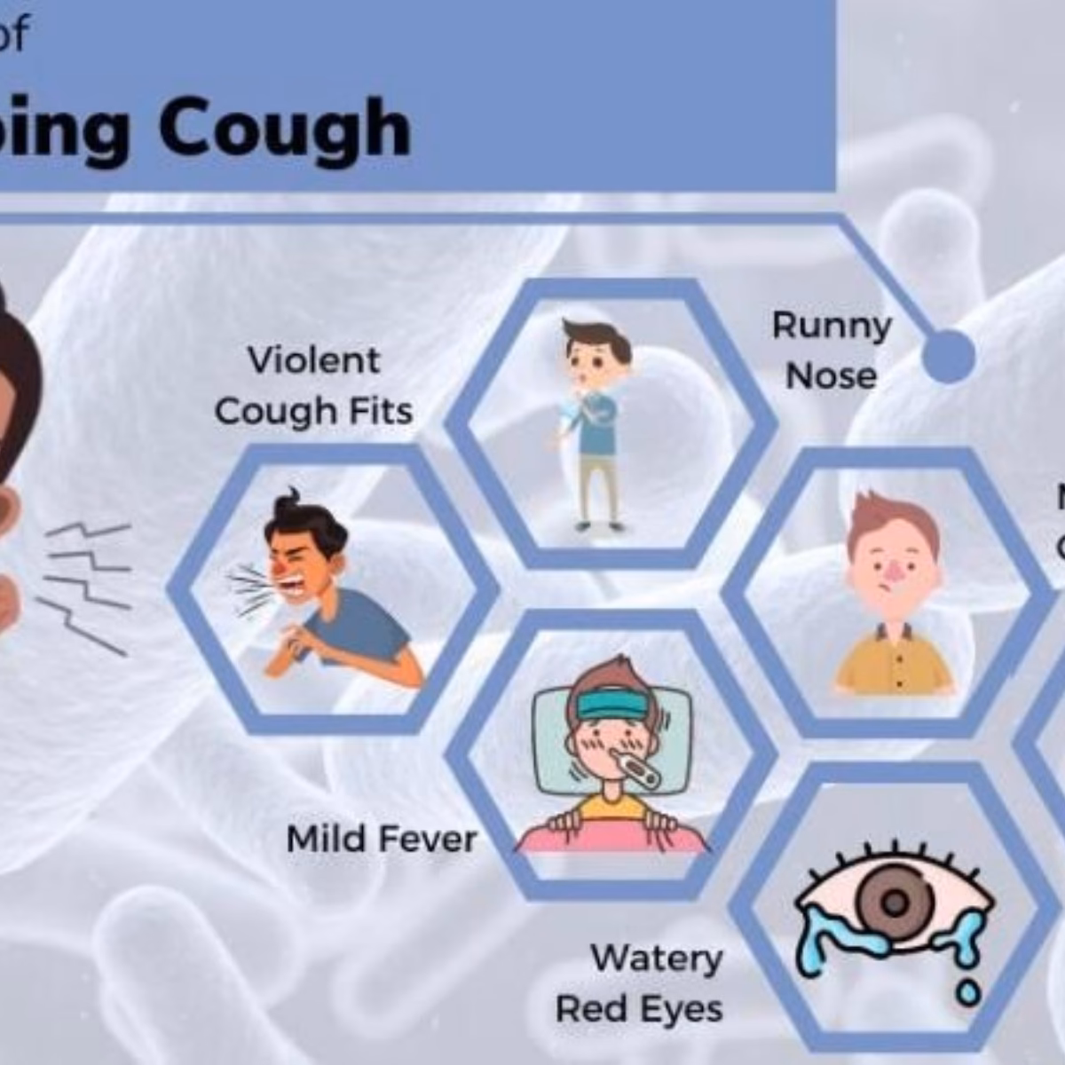 What is Bordetella pertussis (whooping cough)?