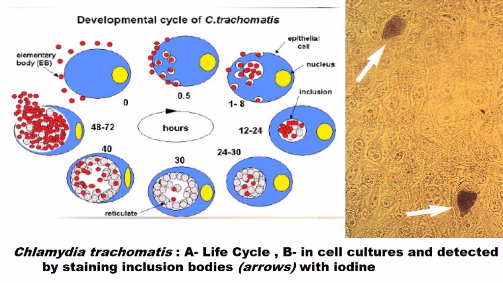 What are the limitations of a chlamydia Gram stain?