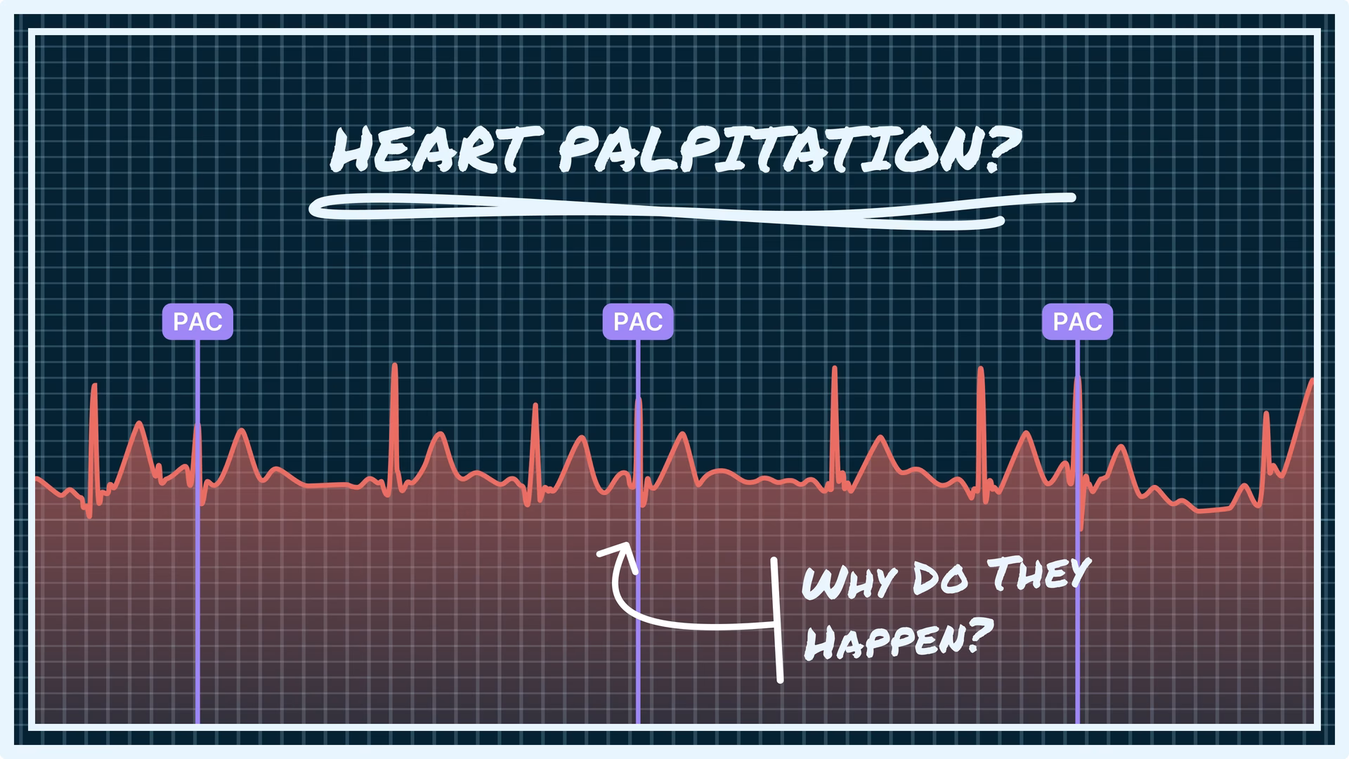Does Xeljanz (tofacitinib) cause serious side effects?