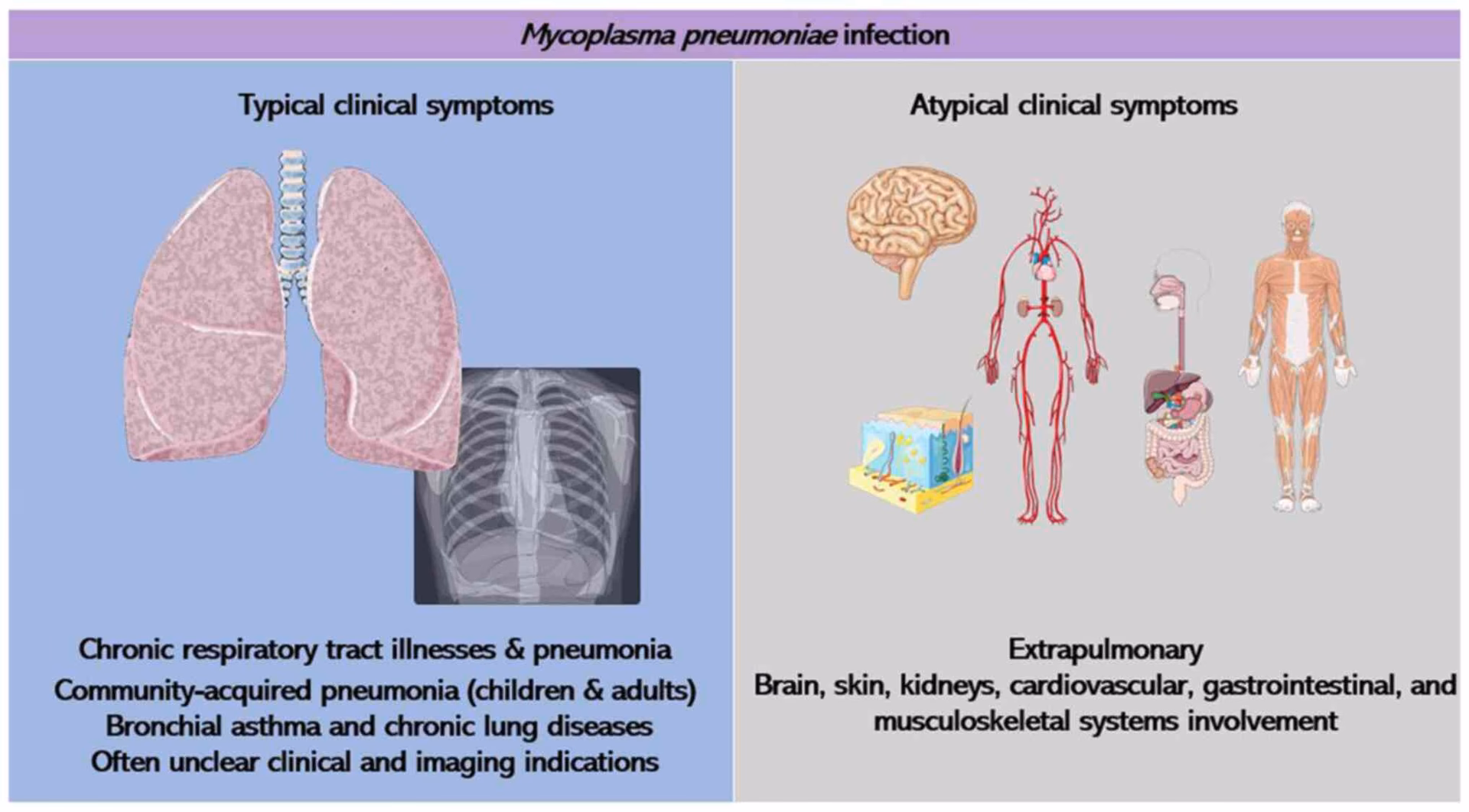 What is the elongated shape of Mycoplasma pneumoniae cells?