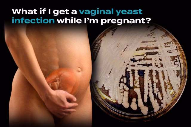 Can a miscarriage cause an infection?