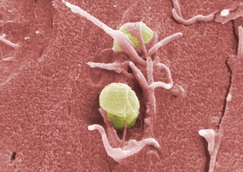 Wie lange dauert eine Yersinien-Infektion?